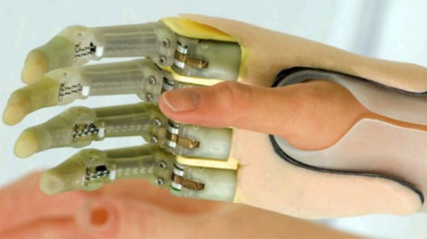 Bionic Hand